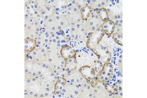 Immunohistochemistry of paraffin-embedded mouse kidney using MTERFD3 antibody at dilution of 1:100 (x40 lens). (MTERFD3 抗体)