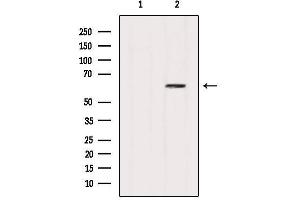 Western Blotting (WB) image for anti-Sequestosome 1 (SQSTM1) (C-Term) antibody (ABIN6263985)