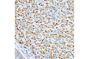 Immunohistochemistry of paraffin-embedded rat ovary using p70 S6 Kinase 2 Rabbit mAb (ABIN7270034) at dilution of 1:100 (40x lens). (RPS6KB2 抗体)