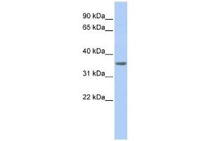 PDHB antibody used at 1 ug/ml to detect target protein. (PDHB 抗体)
