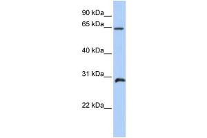 WB Suggested Anti-HOXA5 Antibody Titration: 1 ug/ml Positive Control: Placenta (HOXA5 抗体  (C-Term))