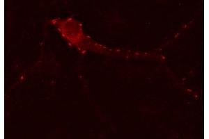 Indirect immunostaining of PFA fixed hippocampus neurons (dilution 1 : 500). (GABRG2 抗体)