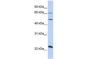 WB Suggested Anti-ZNF597 Antibody Titration:  0. (ZNF597 抗体  (Middle Region))