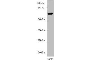Western blot All lanes: PPP2R3B antibody at 2. (PPP2R3B 抗体  (Regulatory Subunit B))