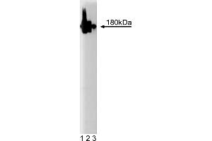 Western Blotting (WB) image for anti-Synaptosomal-Associated Protein 91 (SNAP91) (AA 706-896) antibody (ABIN967993) (SNAP91 抗体  (AA 706-896))