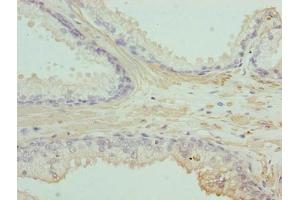 Immunohistochemistry (IHC) image for anti-Actin, gamma 2, Smooth Muscle, Enteric (ACTG2) (AA 181-376) antibody (ABIN7143144)