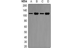 Western blot analysis of E6AP expression in SKOV3 (A), Jurkat (B), mouse brain (C), rat brain (D) whole cell lysates. (ube3a 抗体)