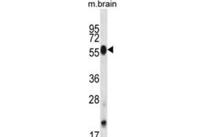 Western Blotting (WB) image for anti-CDC-Like Kinase 4 (CLK4) antibody (ABIN2998111) (CLK4 抗体)
