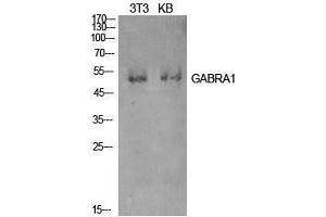 Western Blotting (WB) image for anti-gamma-aminobutyric Acid (GABA) A Receptor, alpha 1 (GABRA1) (Internal Region) antibody (ABIN3181422) (GABRA1 抗体  (Internal Region))