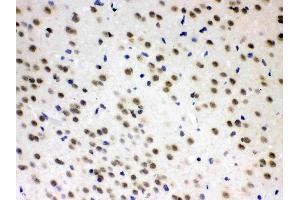 AZIN2 was detected in paraffin-embedded sections of rat brain tissues using rabbit anti- AZIN2 Antigen Affinity purified polyclonal antibody (Catalog # ) at 1 ? (ADC 抗体  (AA 111-301))