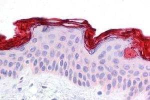 Human Skin: Formalin-Fixed, Paraffin-Embedded (FFPE) (DBT 抗体  (AA 35-84))