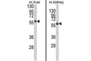 (LEFT) Western blot analysis of PRODH Antibody (RB21343) in mouse liver tissue lysates (35ug/lane). (PRODH 抗体  (Middle Region))