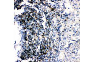 Anti- CD79B picoband antibody,IHC(P) IHC(P): Human Tonsil Tissue