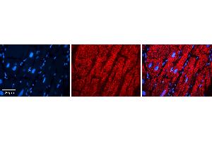 Rabbit Anti-EPRS Antibody   Formalin Fixed Paraffin Embedded Tissue: Human heart Tissue Observed Staining: Cytoplasmic Primary Antibody Concentration: N/A Other Working Concentrations: 1:600 Secondary Antibody: Donkey anti-Rabbit-Cy3 Secondary Antibody Concentration: 1:200 Magnification: 20X Exposure Time: 0. (EPRS 抗体  (Middle Region))