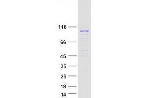 Western Blotting (WB) image for RAS and EF Hand Domain Containing (RASEF) protein (Myc-DYKDDDDK Tag) (ABIN2730534)