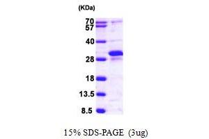 SDS-PAGE (SDS) image for RAS-Like, Estrogen-Regulated, Growth Inhibitor (RERG) (AA 1-199) protein (His tag) (ABIN667876)