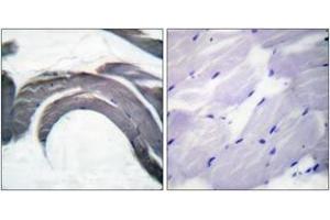 Immunohistochemistry analysis of paraffin-embedded human skeletal muscle, using Glycogen Synthase (Phospho-Ser645) Antibody. (Glycogen Synthase 抗体  (pSer645))