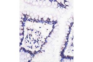 Immunohistochemistry (Paraffin-embedded Sections) (IHC (p)) image for anti-Neurogenin 3 (NEUROG3) (AA 40-69), (N-Term) antibody (ABIN388770)