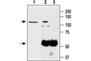 Immunoprecipitation of PC-12 lysates: - 1. (TRPA1 抗体  (1st Extracellular Loop))