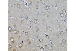 Immunohistochemistry of paraffin-embedded Rat brain using ITGB8 Polyclonal Antibody at dilution of 1:100 (40x lens). (ITGB8 抗体)