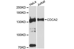 Western blot analysis of extracts of various cell lines, using CDCA2 antibody (ABIN5996800) at 1:3000 dilution. (CDCA2 抗体)