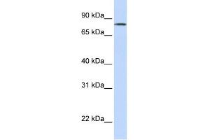 WB Suggested Anti-LST-3TM12 Antibody Titration:  0. (LST-3TM12 抗体  (Middle Region))