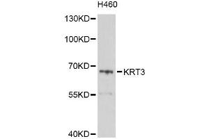 Western blot analysis of extracts of H460 cells, using KRT3 Antibody (ABIN6003816) at 1/1000 dilution. (Keratin 3 抗体)