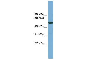 WB Suggested Anti-TMPRSS4 Antibody Titration:  0. (TMPRSS4 抗体  (Middle Region))