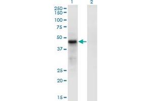 Western Blot analysis of CDC42EP4 expression in transfected 293T cell line by CDC42EP4 monoclonal antibody (M05), clone 3G10. (CDC42EP4 抗体  (AA 163-225))
