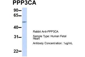 Host:  Rabbit  Target Name:  PPP3CA  Sample Type:  Human Fetal Heart  Antibody Dilution:  1. (PPP3CA 抗体  (Middle Region))