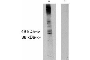 Western blot analysis using LAG1 longevity assurance homolog 2 .