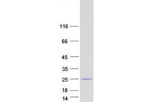 Western Blotting (WB) image for Mediator Complex Subunit 8 (MED8) (Transcript Variant 1) protein (Myc-DYKDDDDK Tag) (ABIN2725752)