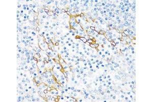 Immunohistochemistry of paraffin-embedded Human tonsil using PLA2G4C Polyclonal Antibody at dilution of 1:100 (40x lens). (PLA2G4C 抗体)