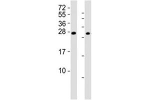 Western blot testing of RHOXF1 antibody at 1:2000 (RHOXF1 抗体  (AA 85-120))