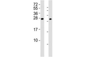 Western blot testing of RHOXF1 antibody at 1:2000 (RHOXF1 抗体  (AA 85-120))