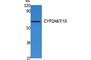 Western Blotting (WB) image for anti-CYP2A6/7/13 (Internal Region) antibody (ABIN3178124) (CYP2A6/7/13 (Internal Region) 抗体)
