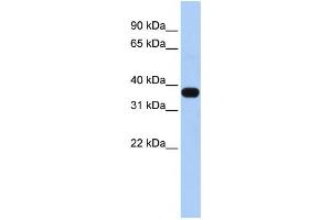 Western Blotting (WB) image for anti-Mitochondrial E3 Ubiquitin Protein Ligase 1 (MUL1) antibody (ABIN2458733) (MUL1 抗体)