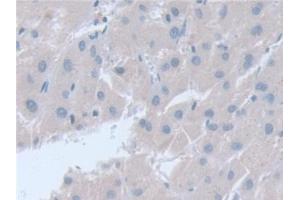 Detection of SNAP23 in Human Liver Tissue using Polyclonal Antibody to Synaptosomal Associated Protein 23 kDa (SNAP23) (SNAP23 抗体  (AA 1-211))