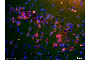 Formalin-fixed and paraffin embedded rat brain carcinoma labeled with Rabbit Anti-ApoA4 Polyclonal Antibody, Unconjugated (ABIN749153) at 1:200 followed by secondary antibody was Goat Anti-Rabbit IgG, Cy3 conjugated used at 1:200 dilution for 40 minutes at 37°C. (APOA4 抗体  (AA 21-120))