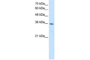 WB Suggested Anti-MTHFD2 Antibody Titration:  1. (MTHFD2 抗体  (N-Term))