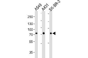Western blot analysis of lysates from A549, A431, SK-BR-3 cell line (from left to right), using CN2 Antibody (ABIN6244177 and ABIN6577076). (Calpain 2 抗体  (AA 1-400))