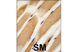 Formalin-fixed and paraffin-embedded human skeletal muscle tissue reacted with ACTB/ACTC antibody , which was peroxidase-conjugated to the secondary antibody, followed by DAB staining. (Actin 抗体  (AA 189-218))