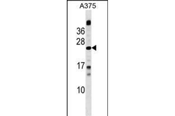 MBD3L1 antibody  (C-Term)