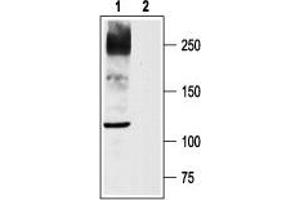 Western blot analysis of rat DRG lysates: - 1. (Nav1.8 抗体  (C-Term, Intracellular))