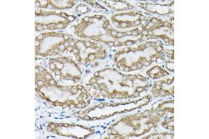 Immunohistochemistry of paraffin-embedded mouse kidney using Phospho-KRAS-S89 Rabbit pAb (ABIN7267530) at dilution of 1:100 (40x lens). (K-RAS 抗体  (pSer89))