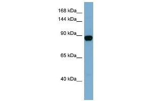CASD1 antibody used at 1 ug/ml to detect target protein. (CASD1 抗体  (N-Term))