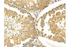 ABIN6262741 and ABIN6276579 at 1/100 staining Rat testis tissue by IHC-P.