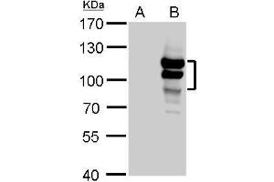 WB Image L3MBTL antibody detects L3MBTL protein by Western blot analysis. (L3MBTL1 抗体  (Center))