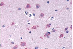 Anti-GPRC6A antibody  ABIN1048920 IHC staining of human brain, neurons and glia. (GPRC6A 抗体  (N-Term))
