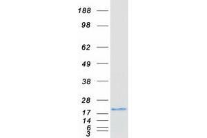 Western Blotting (WB) image for Cysteine Dioxygenase, Type I (CDO1) protein (Myc-DYKDDDDK Tag) (ABIN2713884)